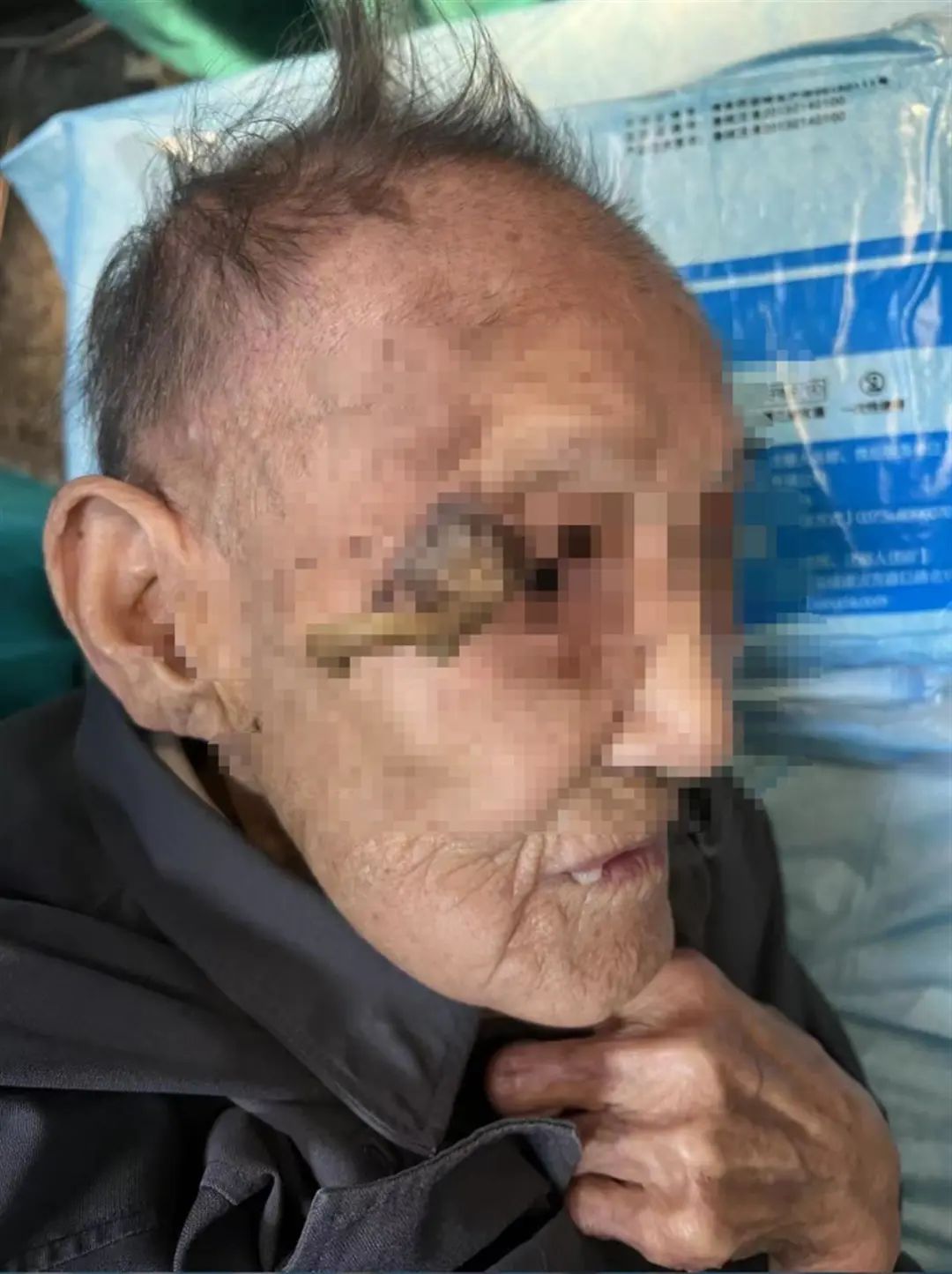 太狠了！上海一老人拿起剪刀，居然把自己身上的…剪掉了！医生也傻眼了…