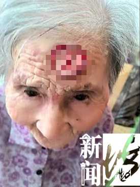 太狠了！上海一老人拿起剪刀，居然把自己身上的…剪掉了！医生也傻眼了…