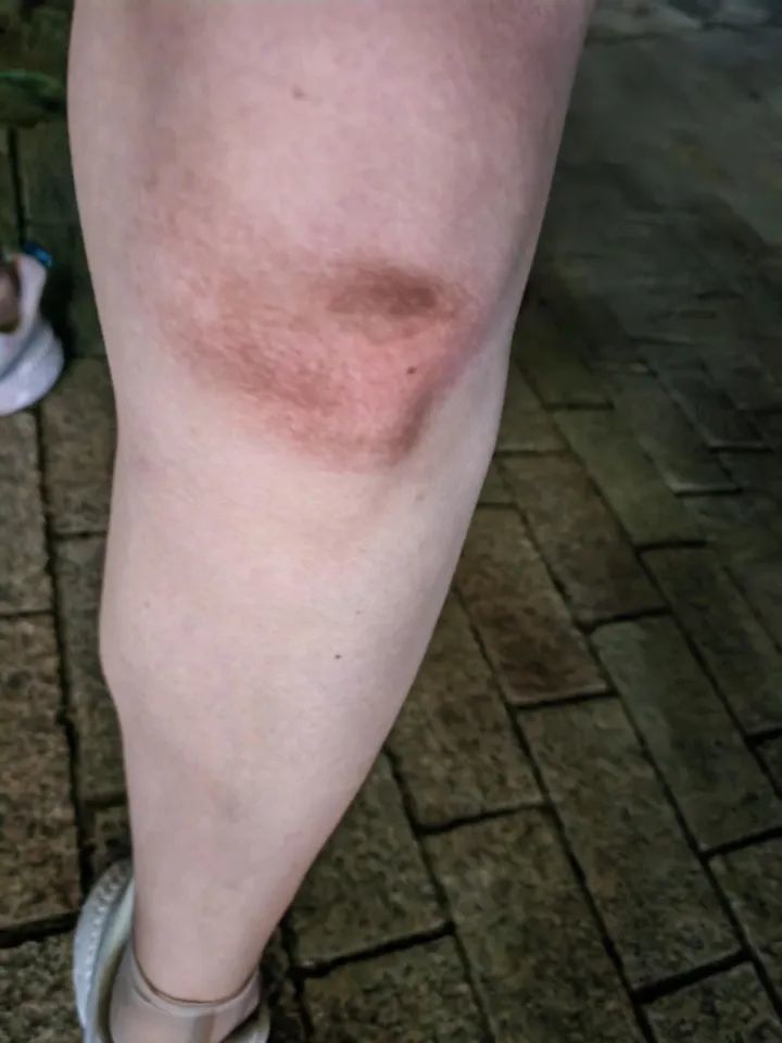 事发台州！一男子夜跑心脏骤停倒地！关键时刻……