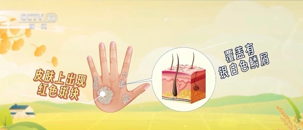 朝“问”健康丨处暑到 这些健康妙招防秋燥 朝“问”健康丨处暑到 这些健康妙招防秋燥