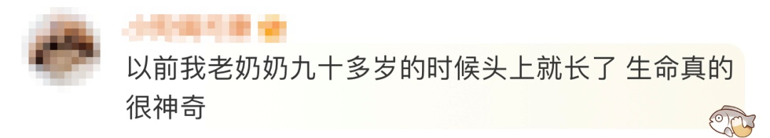 太狠了！上海一老人拿起剪刀，居然把自己身上的…剪掉了！医生也傻眼了…