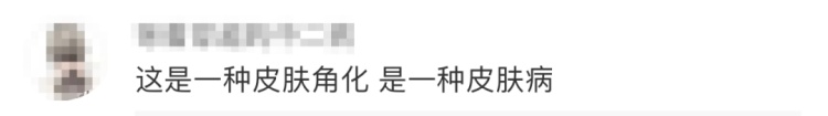 太狠了!98岁老人头上长“角”?一剪刀下去,后果严重!医生也傻眼了…… 太狠了!98岁老人头上长“角”?一剪刀下去,后果严重!医生也傻眼了……