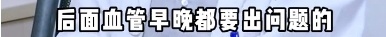 上海三甲医院脑梗专家自曝确诊脑梗!这些高危因素千万警惕 上海三甲医院脑梗专家自曝确诊脑梗!这些高危因素千万警惕