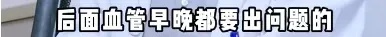 上海三甲医院脑梗专家自己也脑梗了！曾高烧40度做手术！这些高危因素千万警惕