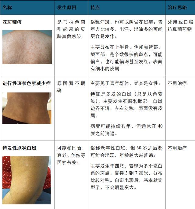 身上突然白了一块，到底是怎么回事？是得了白癜风吗？