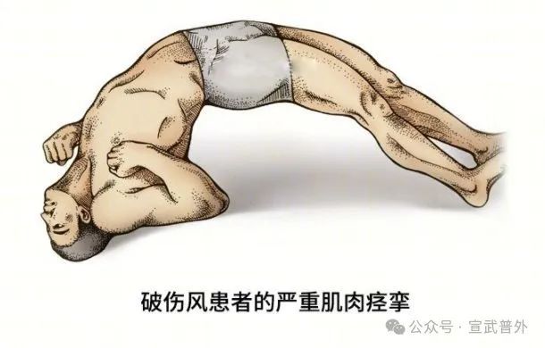 小小伤口，大大伤害！