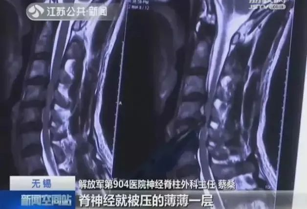 “差点这辈子都站不起来了”,19岁大学生痛哭!这个常见动作害了太多人 “差点这辈子都站不起来了”,19岁大学生痛哭!这个常见动作害了太多人