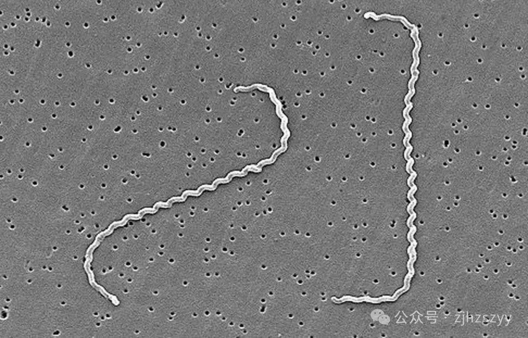 10秒感染,男子高烧42℃险丧命!人人可能中招 10秒感染,男子高烧42℃险丧命!人人可能中招