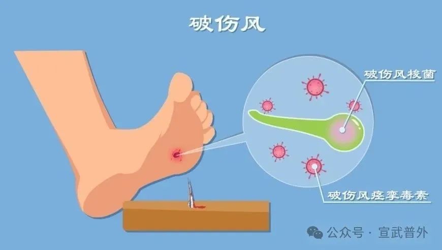 小小伤口，大大伤害！