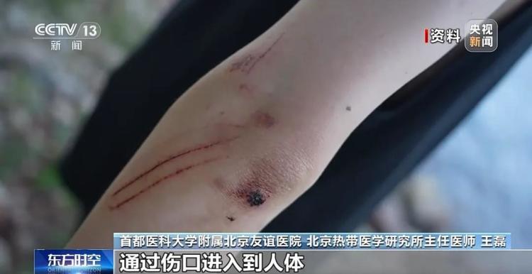 一月两起“食脑虫”夺命悲剧 玩水如何避开致命威胁？