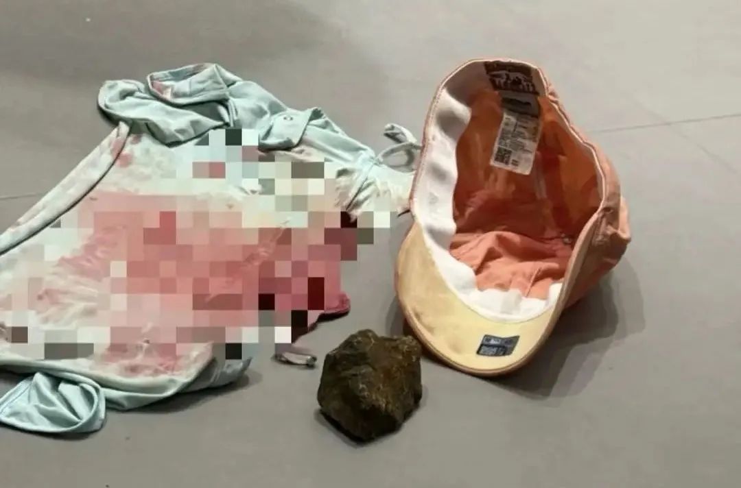 女子漂流被12岁男孩扔石头砸伤头部!急寻目击者!准备起诉 女子漂流被12岁男孩扔石头砸伤头部!急寻目击者!准备起诉