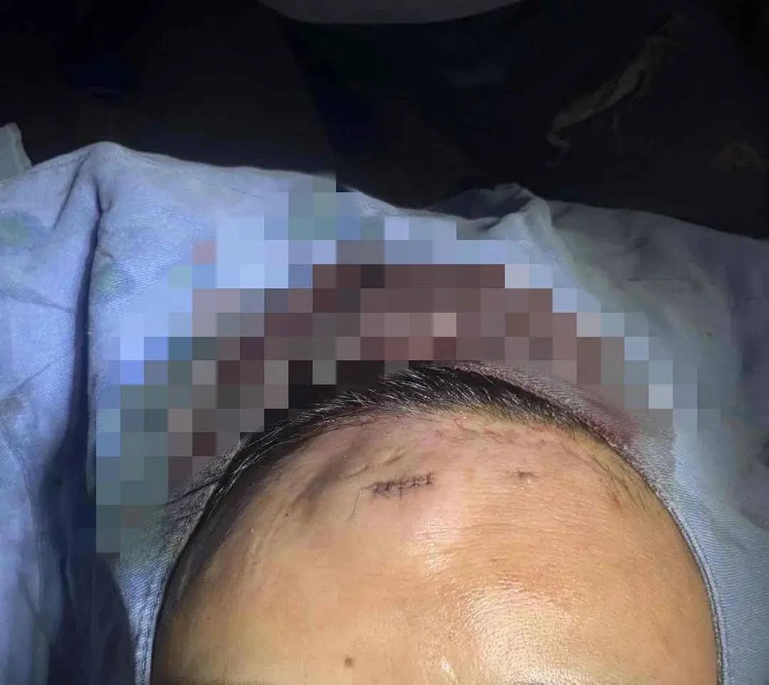 女子漂流被12岁男孩扔石头砸伤头部!急寻目击者!准备起诉 女子漂流被12岁男孩扔石头砸伤头部!急寻目击者!准备起诉