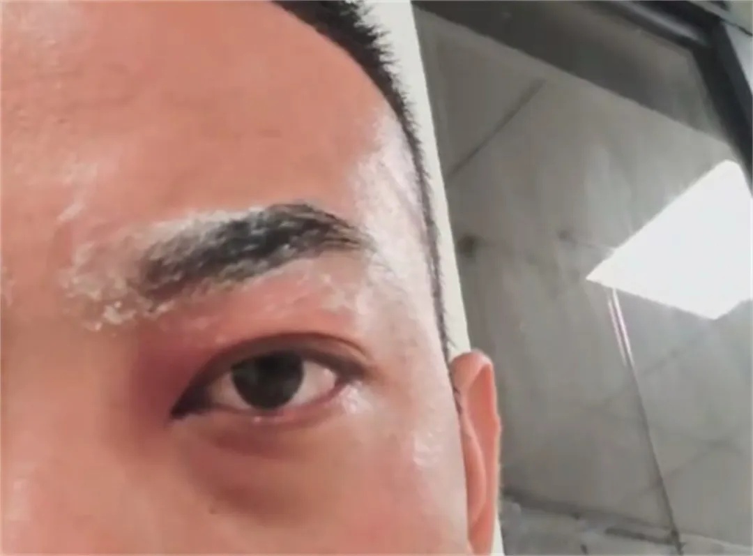 八旬老人被蛰100多下后不幸身亡！已进入高发期，紧急提醒