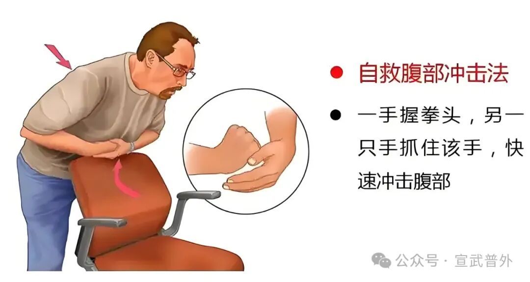 一招“顶”命,必学海姆立克! 一招“顶”命,必学海姆立克!