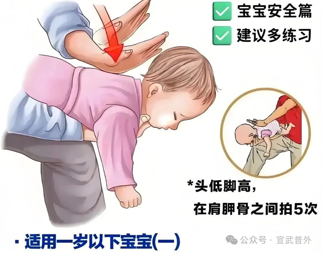 一招“顶”命,必学海姆立克! 一招“顶”命,必学海姆立克!