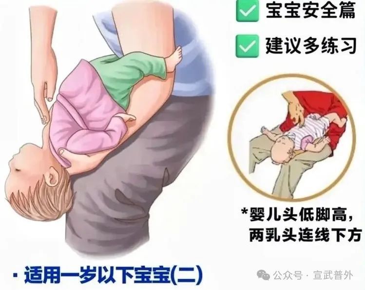 一招“顶”命,必学海姆立克! 一招“顶”命,必学海姆立克!