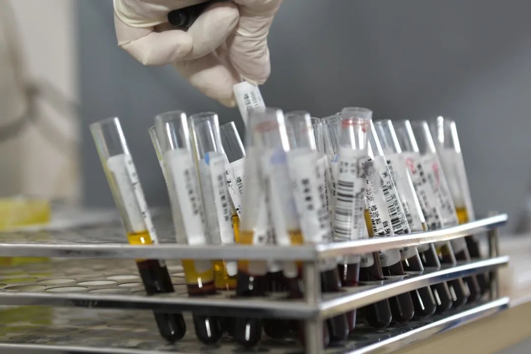 注意！9个身体信号，说明肾脏在“求助”