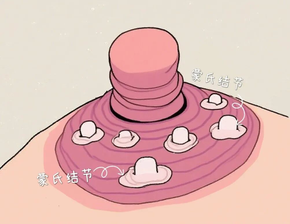 有毒、还会致癌?这种贴身用品,有人最近天天用!紧急提醒 有毒、还会致癌?这种贴身用品,有人最近天天用!紧急提醒