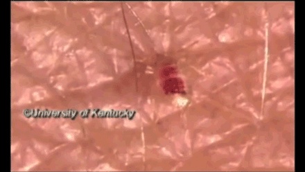 最近！臭虫大爆发！注意！注意！注意！