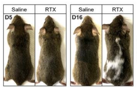 白头发拔一根长三根？到底能不能拔？终于弄清楚了！