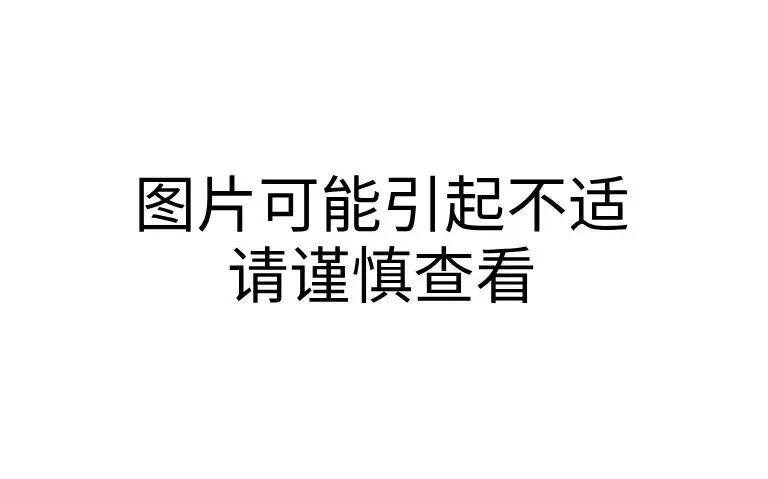 最近！臭虫大爆发！注意！注意！注意！