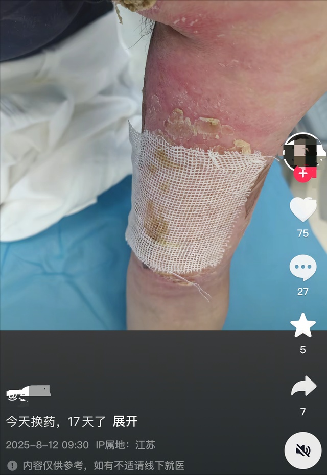 顾客打翻餐桌杯子弄湿地面，女服务员端砂锅上菜滑倒被烫伤，律师分析法律责任