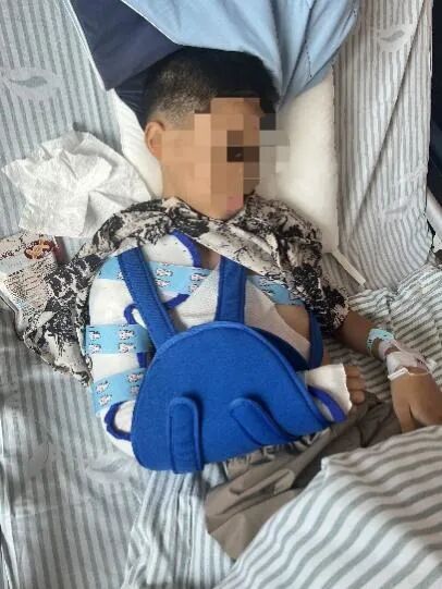 太疼了！10岁男孩拿洗衣机里衣物，右臂卷入致骨折！医生提醒