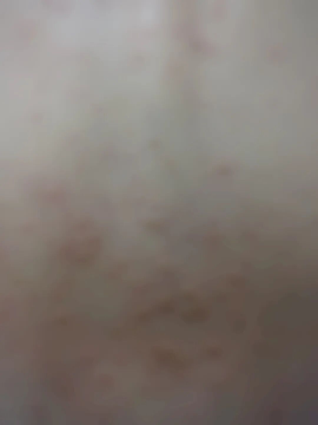 半夜醒来，床单上全是血！像有蚂蚁在骨头缝里爬！杭州55岁阿姨：没想到竟是它惹的祸…