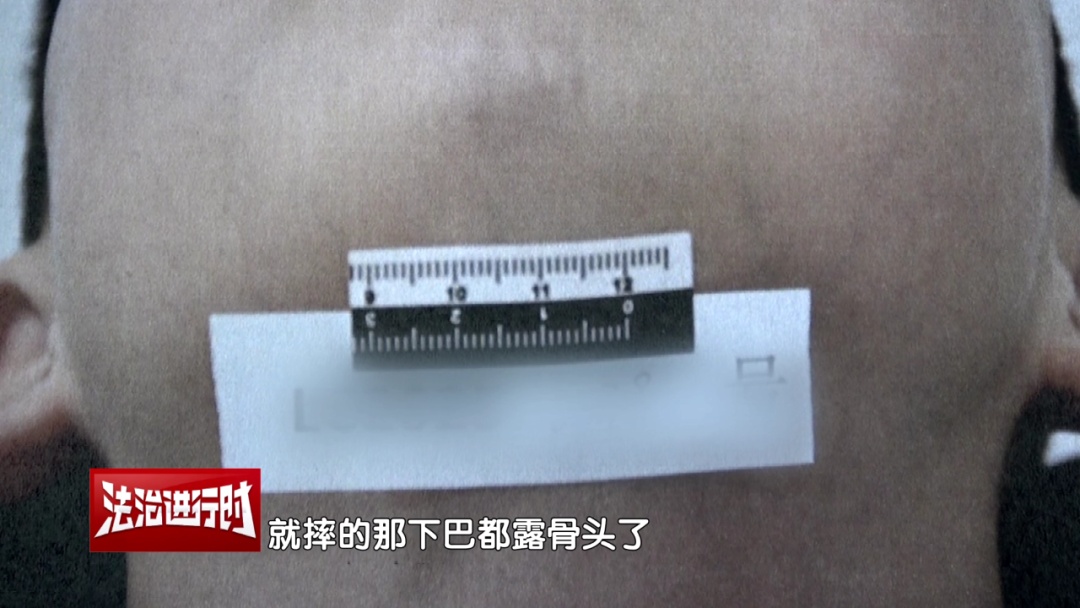 5岁孩子在幼儿园盥洗室摔伤，法院宣判！