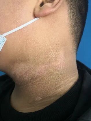 脖子总是黑黑的洗不干净？不是邋遢，可能是身体发出的警报！