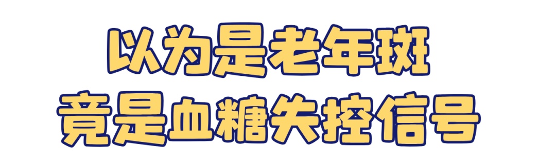 小腿出现这种斑，竟是身体在“求救”！很多人误以为是……