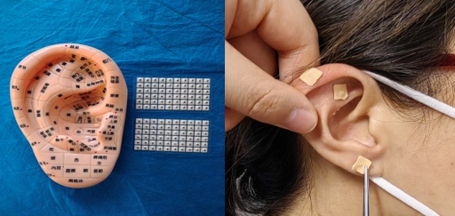 每天被喷嚏叫醒?鼻炎患者:中医这几招亲测有效 每天被喷嚏叫醒?鼻炎患者:中医这几招亲测有效