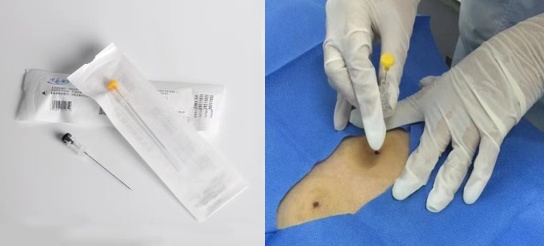 每天被喷嚏叫醒?鼻炎患者:中医这几招亲测有效 每天被喷嚏叫醒?鼻炎患者:中医这几招亲测有效