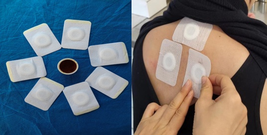 每天被喷嚏叫醒?鼻炎患者:中医这几招亲测有效 每天被喷嚏叫醒?鼻炎患者:中医这几招亲测有效