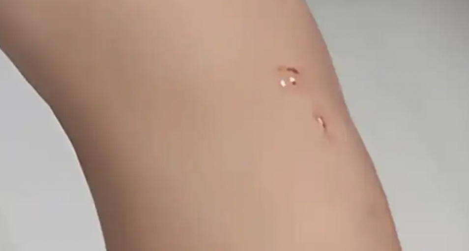 马桶里惊现蝙蝠，女子这样做被咬伤！