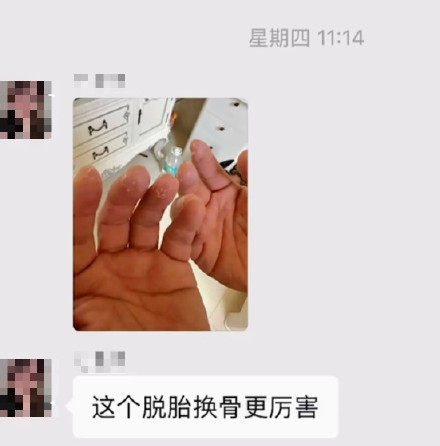 北极圈徒步后得了“指尖脱皮症”？医生：或与长时间戴手套有关