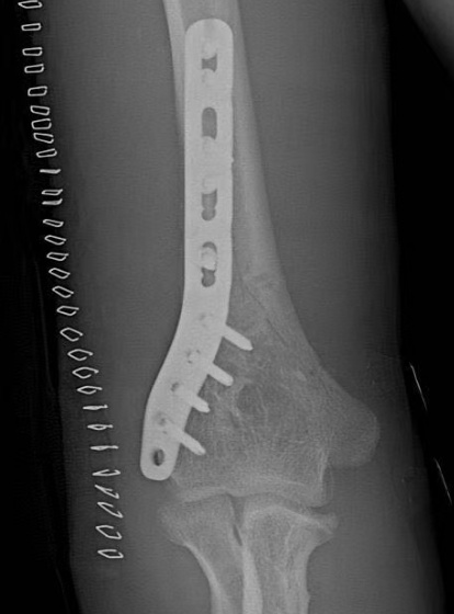 小伙猛地发力后"咔嚓"一声,这部位当场报废!医生:别再瞎较劲! 小伙猛地发力后"咔嚓"一声,这部位当场报废!医生:别再瞎较劲!