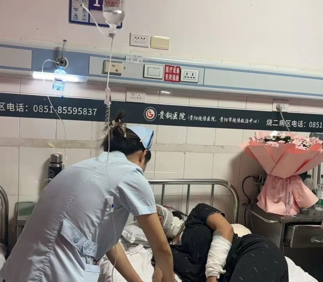 烧纸突然发生爆燃，女子被严重烧伤！祭祀注意勿惹火……