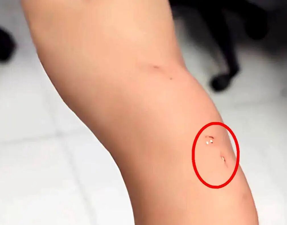 一旦被咬伤就是Ⅲ级暴露!家中发现它,千万别徒手抓! 一旦被咬伤就是Ⅲ级暴露!家中发现它,千万别徒手抓!