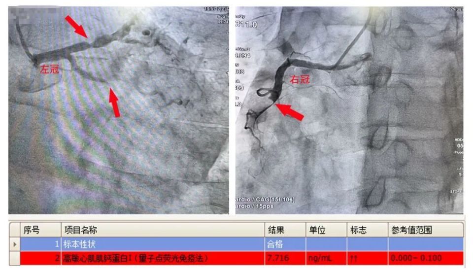 浙江一男子肚子胀得难受,好几天没法排便,医生一看,倒吸了一口凉气 浙江一男子肚子胀得难受,好几天没法排便,医生一看,倒吸了一口凉气
