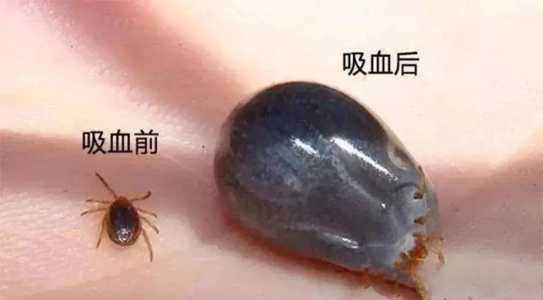 当心被它叮咬！已有人被送进ICU