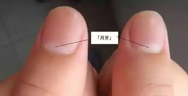 指甲上没有月牙，是我身体虚吗？