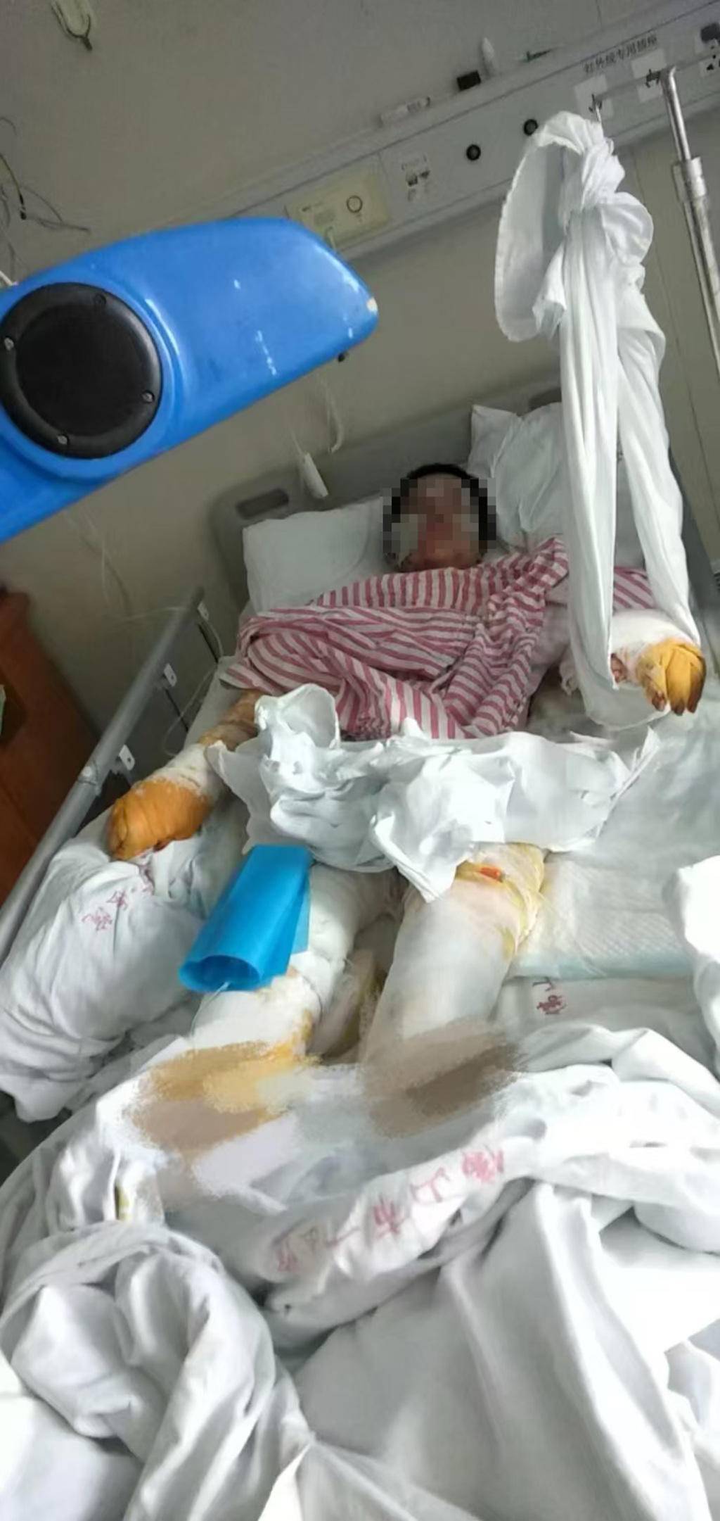 男子求爱遭拒等民警离开后泼硫酸捅刺女子数十刀，终审判死刑