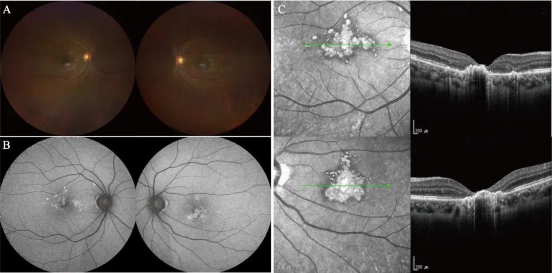 一女子突然确诊,受伤时竟没有痛感!别买!很多人家里有 一女子突然确诊,受伤时竟没有痛感!别买!很多人家里有