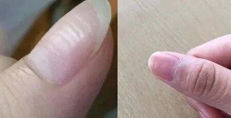 指甲上没有月牙，是我身体虚吗？