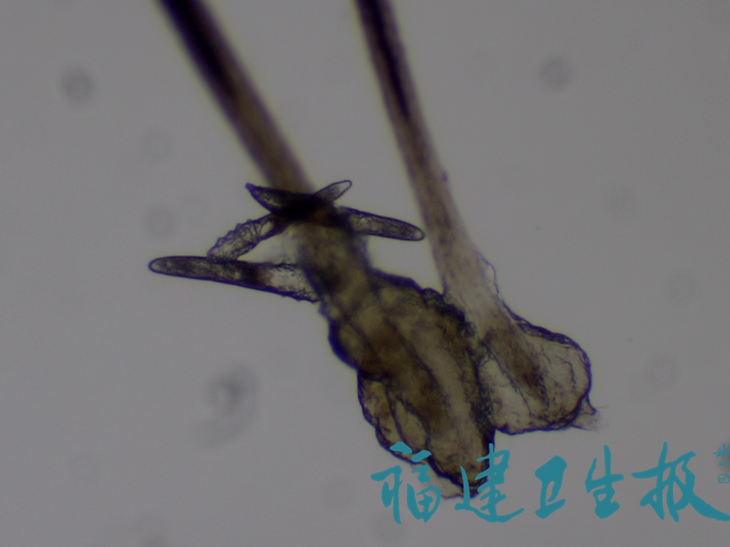 福建女子常常熬夜干这事，医生一看惊了：这个地方爬满虫……