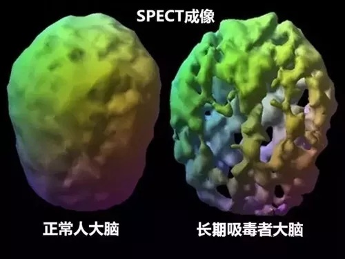 “警察叔叔，我吸毒了，我来自首”……