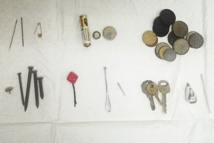 1岁半孩子的食道因TA腐蚀穿孔!家中的“小圆片”快收好 1岁半孩子的食道因TA腐蚀穿孔!家中的“小圆片”快收好