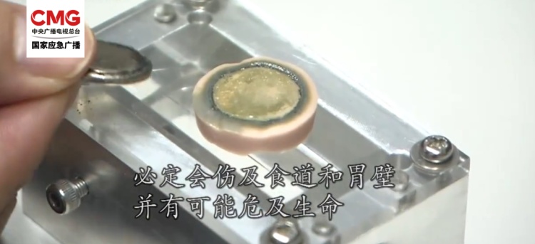 1岁半孩子的食道因TA腐蚀穿孔!家中的“小圆片”快收好 1岁半孩子的食道因TA腐蚀穿孔!家中的“小圆片”快收好