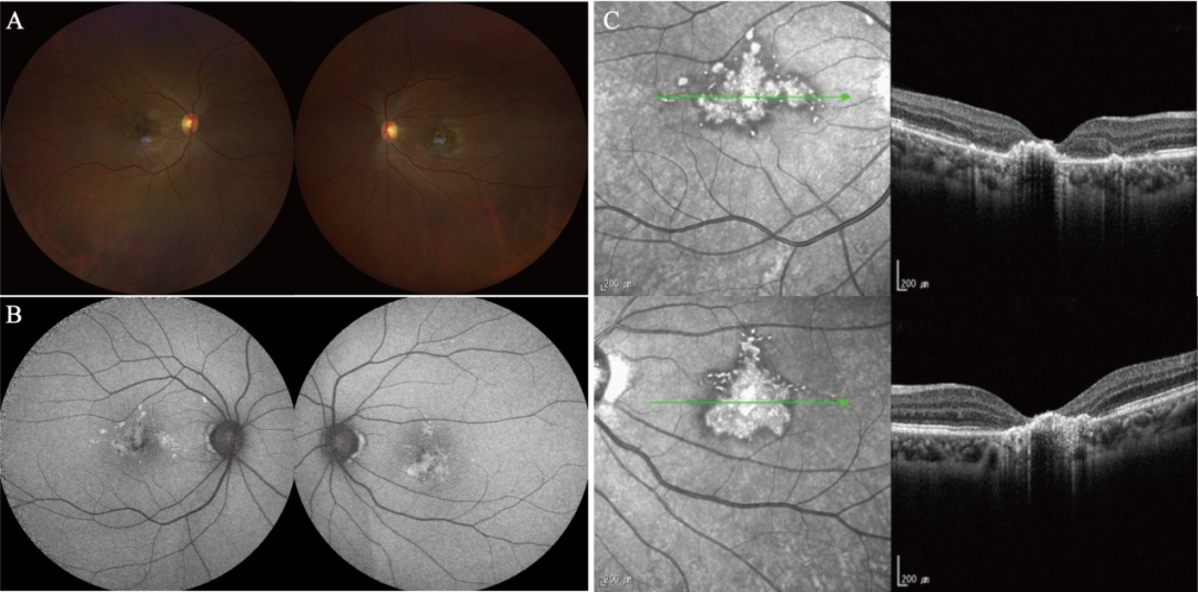 别买！她“逗猫”一月，视力骤降，康复希望渺茫……很多人家里都有